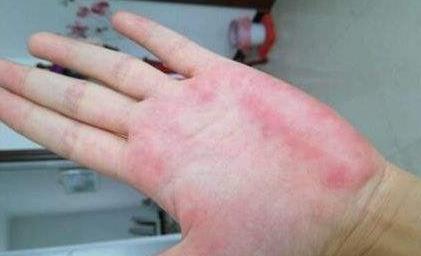 『肝脏』肝不好的人，这3种食物要少吃，尤其第1种，吃越多，肝“毒”越深！