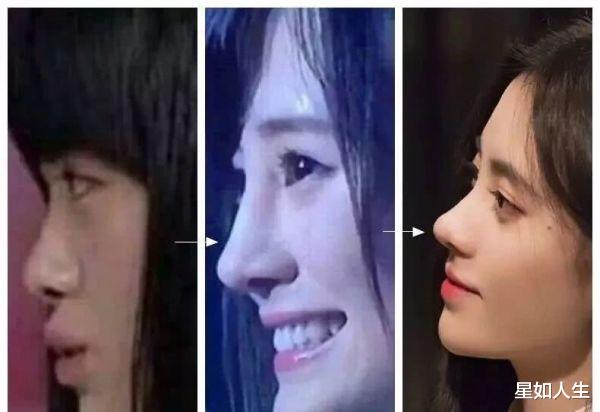 鞠婧祎@鞠婧祎综艺首秀翻车，翘鼻尖被嘲像匹诺曹，娱记直指她整容成瘾？