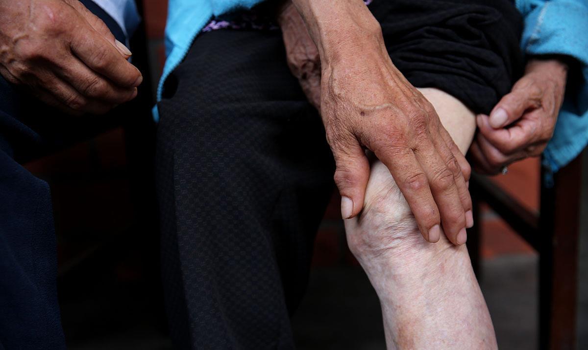 尿酸|尿酸偏高的人,身体或有4个表现,若一条不中,说明尿酸还算稳定