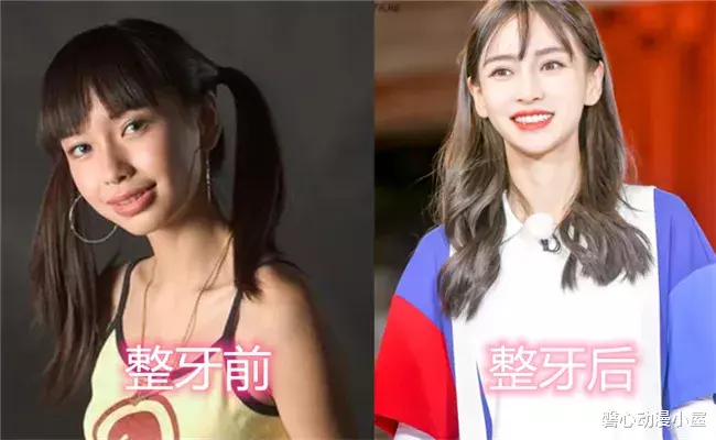 唐艺昕■有种“逆袭”叫整牙后，杨颖、唐艺昕变美，可看到她：还不如不整