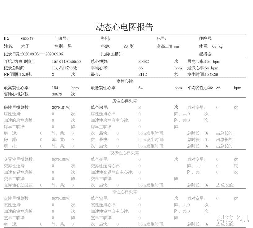 小米科技|小米众筹上线智能动态心电仪，可24小时动态监测，售499元