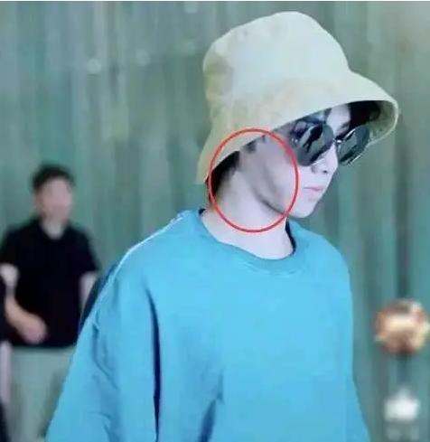 华晨宇整容失败恐成削骨天帝?自肖战被曝整容之后又有大v爆料