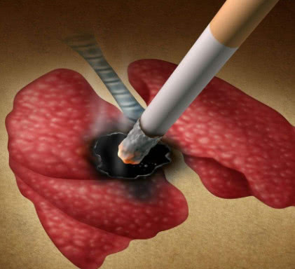 「香蕉」呼吸科主任：烟瘾再大，只要这4个时间不吸烟！肺一辈子没毛病！