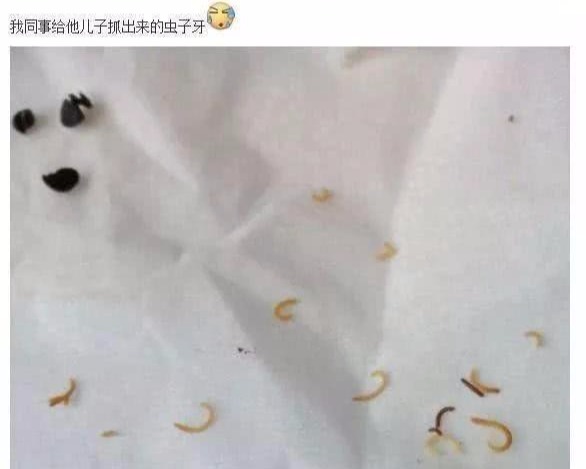#牙齿#人的牙齿为什么会生虫子?看完涨知识了!