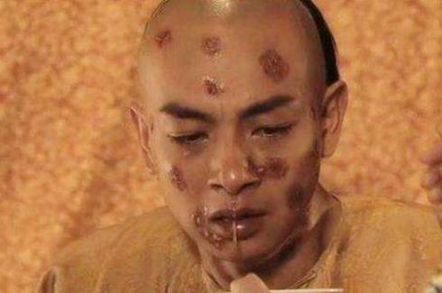 天花■古代五大“绝症”,古人得了这五种病,基本就要给自己准备后事了