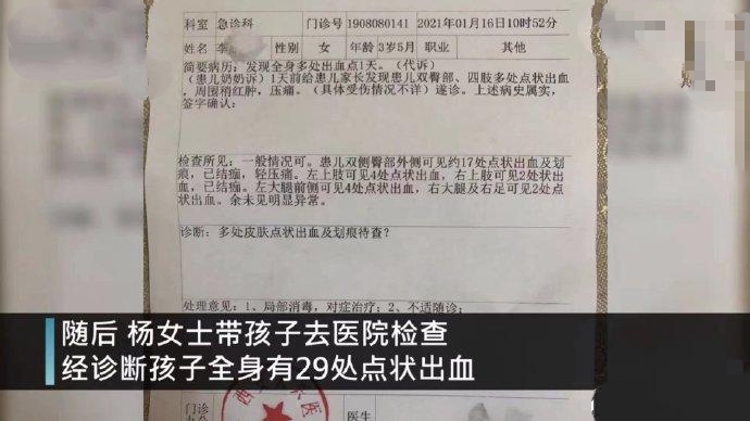 大地之子 该不该把孩子送幼儿园？西安一女童身上现29处针眼，幼师回应系做梦