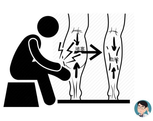 饮食：血管堵塞，这两处先知！2个部位越痛，血管可能越“堵”，需重视