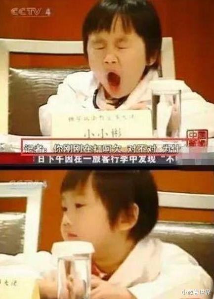 「小小彬」他给亲爸买豪宅, 赚钱给后妈整容, 皮肤溃烂却遭袖手旁观, 今怎样了