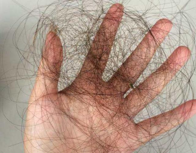 洗发水：这3种洗发水被列入“黑名单”了，你还在用吗？难怪发质差