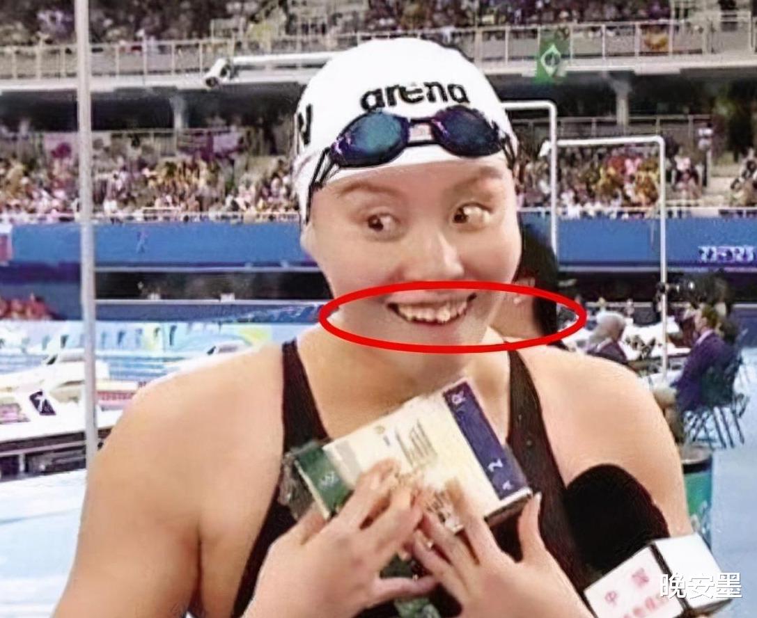 邓超|傅园慧整牙后美到不敢认，效果堪比整容，网友：给baby道歉