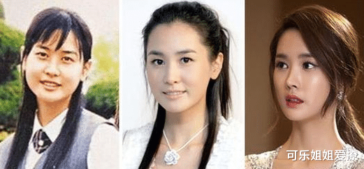 整容|因整容走上颜值巅峰，14年却不见手术后遗症，如今美成整容模板