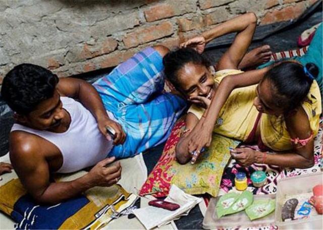 晓君侃史|靠展览为生的连体姐妹，爱上同一个男人，拒绝医生的免费分离手术