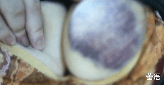 护理|女子花7980元做胸部护理，因太用力过猛，导致胸部被捏成紫色