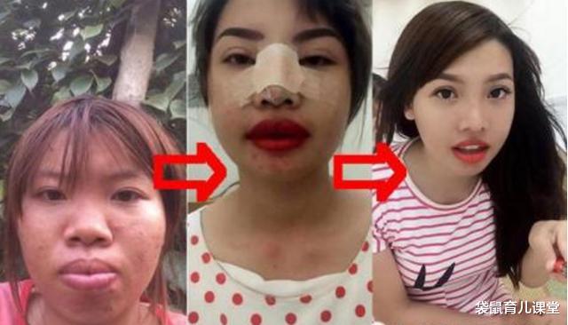 【整容】她曾因相貌太丑而整容，后嫁给富二代，如今3年过去女儿长成这样