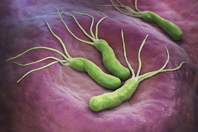 幽门螺杆菌|消化科医生：1种食物敞开吃，避免幽门螺杆菌感染，胃好不生病