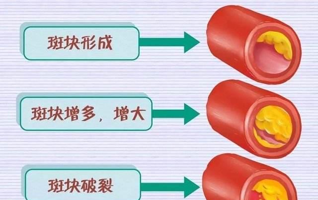 中老年人|百岁老人直言:迈开腿不如管住嘴,一物常吃,血脂或降到正常