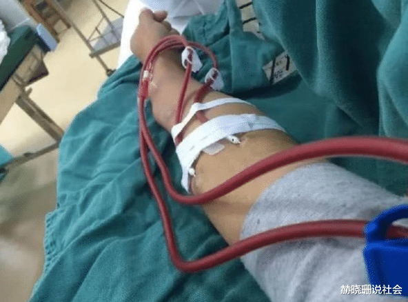 肝脏@年轻小伙被查出尿毒症，需要终身透析，只因一件事做太多“肾受不了”