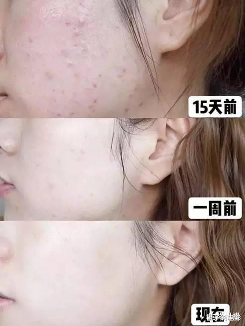 洗面奶|被列入“黑名单”的几款洗面奶，皮肤越洗越糟，有就赶快扔了吧！