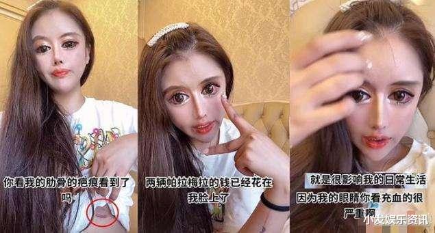 整容|网红13岁起整容100次！炫耀去赖冠霖公司面试，网友：你的才艺就是脸吓人