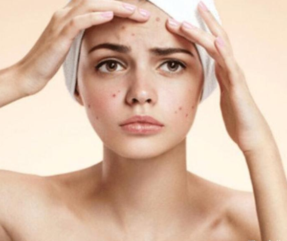 爽肤水|洗脸后护肤的讲究，你都知道吗？很多人都用错了，难怪皮肤越来越差