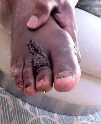 「广东男篮」NBA球星的脚趾：奥尼尔最恶心，老詹乔治最畸形，看到马布里我服了