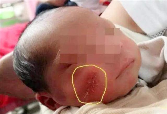 臆说古史|还记得那个被妈妈用剪刀划伤脸的男婴吗？时隔4年，如今成小网红