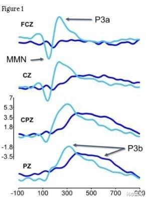 火星探测|研究发现，死亡时或可听到声音，临终告别要谨言慎行