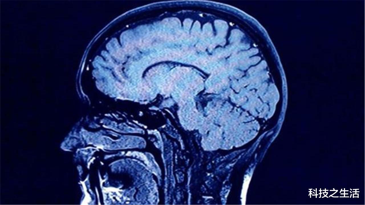 宇航员|人类在被圈养？宇航员进入宇宙大脑膨胀变形，我们真走不出去吗？