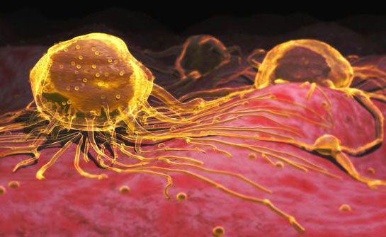 癌细胞|癌细胞“最怕”的5种食物，生活中常吃点，远离癌症，身体更健康！