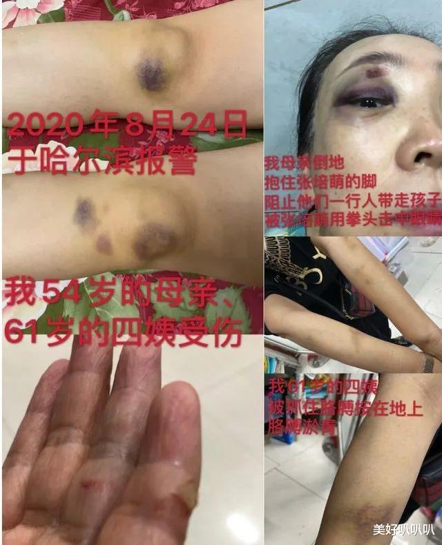 张培萌|百米飞人张培萌再无翻身之日！其妻子曝光一个视频，画面真的揪心