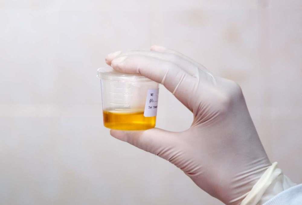 排毒|肾不好的人,是不是应该多喝水?答案可能会让你感到意外