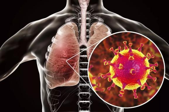 [血糖]新冠肺炎最新研究发现：血糖控制与死亡率密切相关