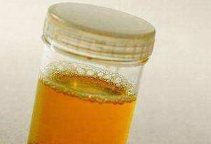 肝脏|医生提醒：饮酒者，晨起若有4种异常，小心肝脏受损，及时戒酒