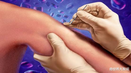 【】地球仅存的天花病毒保存在美俄实验室，为什么拖延40年还不肯销毁