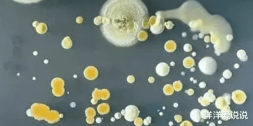 睡眠|央视曝光:比马桶还脏,是病毒的最佳载体,你却天天抱着吃饭