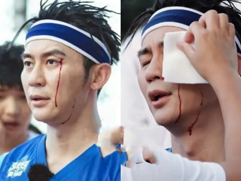 任嘉伦▲综艺节目危险重重：李晨破相，热巴遭遇骚扰，他们却在拍摄中离世