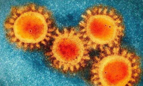 『美国』北京时间6月14日，美国传来悲惨消息，美媒：特朗普在加速“美国大屠杀”！