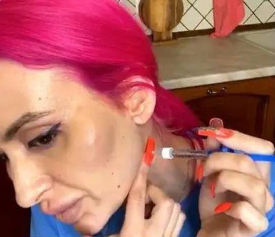 秦昊|沉迷整容的网红，没钱去医院，自己给自己打针，结果整成这样