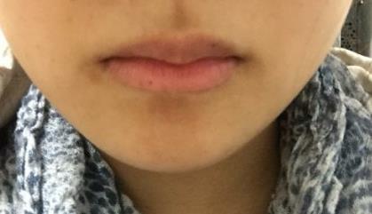 「肝脏」身上4处发黑，说明肝脏在“求救”，多吃补肝水果，预防肝病