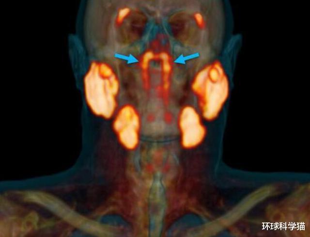 科学家|人类进化没有停?科学家或发现“此前未知”的器官,隐藏很好