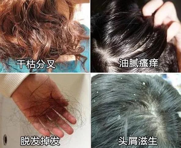 洗发水|已经被拉入“黑名单”的洗发水,部分人还在用,难怪头发“大把掉”