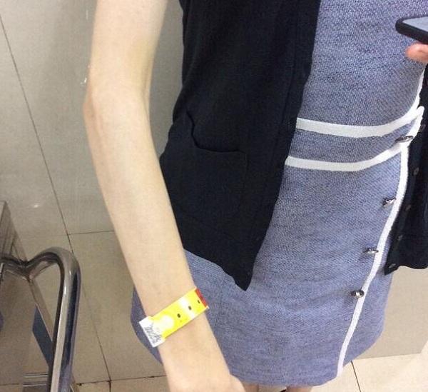 话晴空|杭州13岁初中生，短时间内体重掉到60斤，医生：催吐手