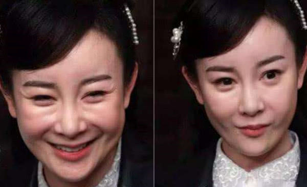「整容」整容千万不能乱整，张檬、郑爽都是反面教材，唯独戚薇机智