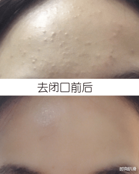 马鞭草 李小冉也太招“仇恨”了，44岁脸上一点暗沉没有，完美的牛奶色肌肤