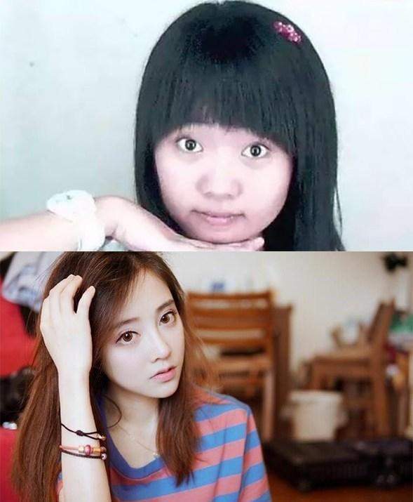 全方位地深扒冯提莫的整容历史, 究竟是"换脸怪"还