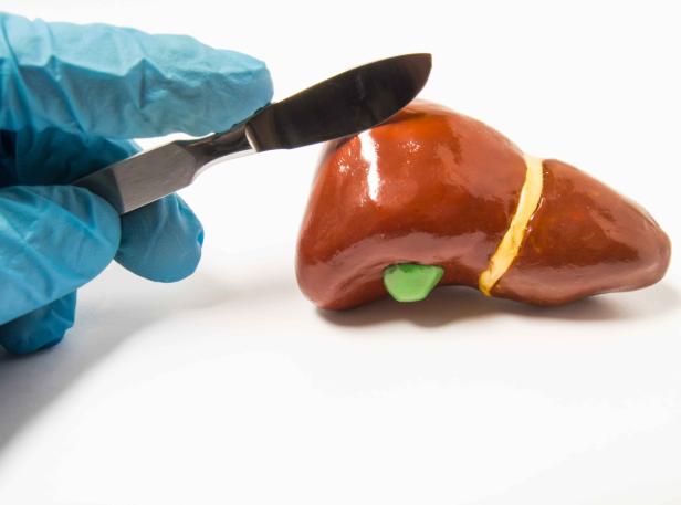 肝脏|身上长出小红斑注意了，可能不是皮肤问题，或是肝发出的求救信号