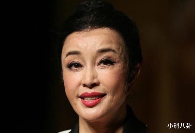 被玻尿酸毁了的六大女星,王心凌像老太太,而她丑到不可接受
