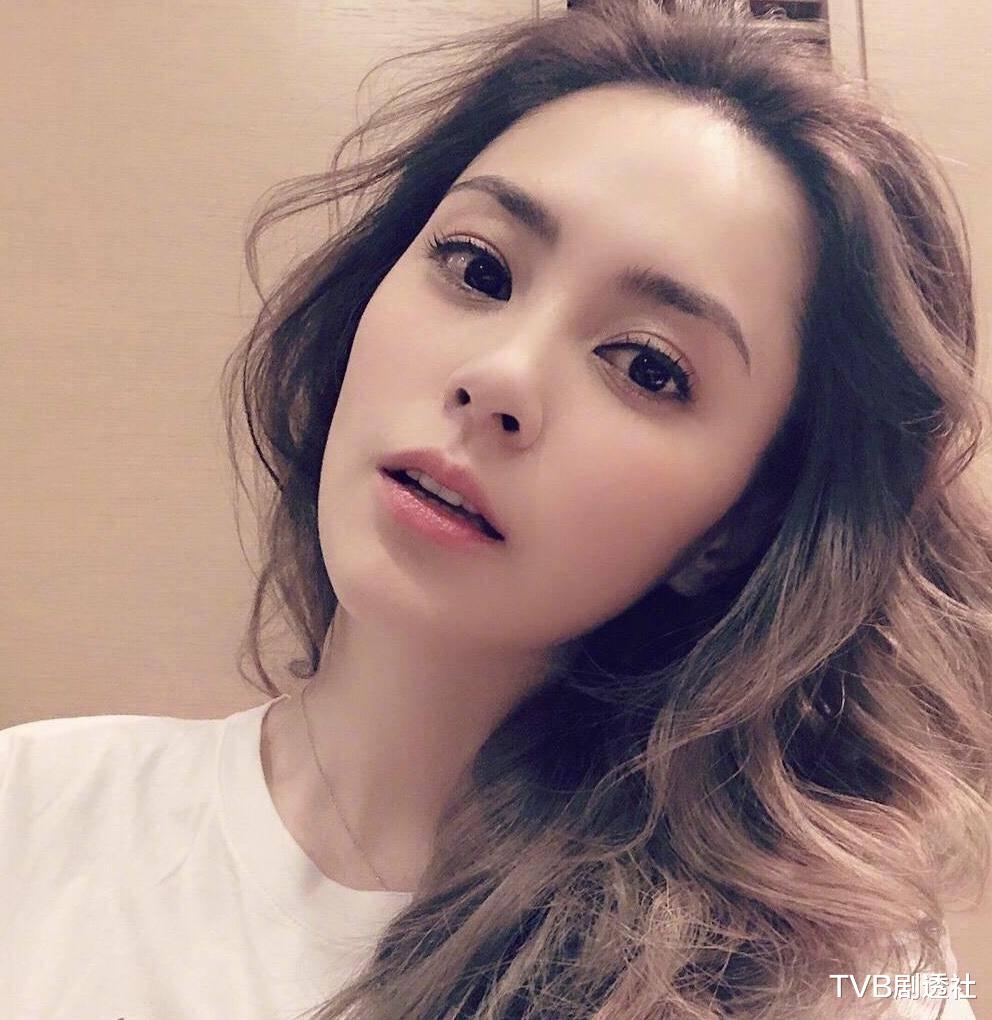 阿娇|阿娇首晒伤口照!眉骨留下近5厘米蜈蚣疤,伤痕清晰可见