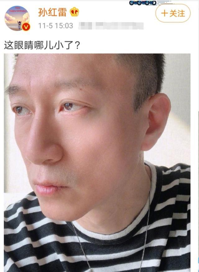 孙红雷|孙红雷又晒自拍，穿嫩紫色毛衣出镜瘦到脸颊凹陷，网友评论太奇葩
