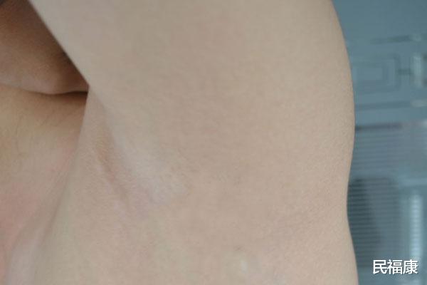 饮食：腋毛浓密的女性和腋毛稀疏的女性，有什么不一样？谁的身体更好？